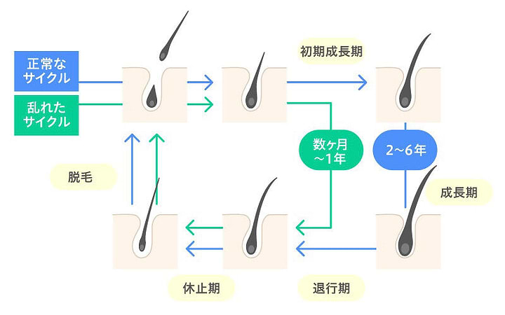 発毛サイクル